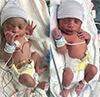 Jagun's Twins, New Arrival Baby image for Jenkins Obstetrics